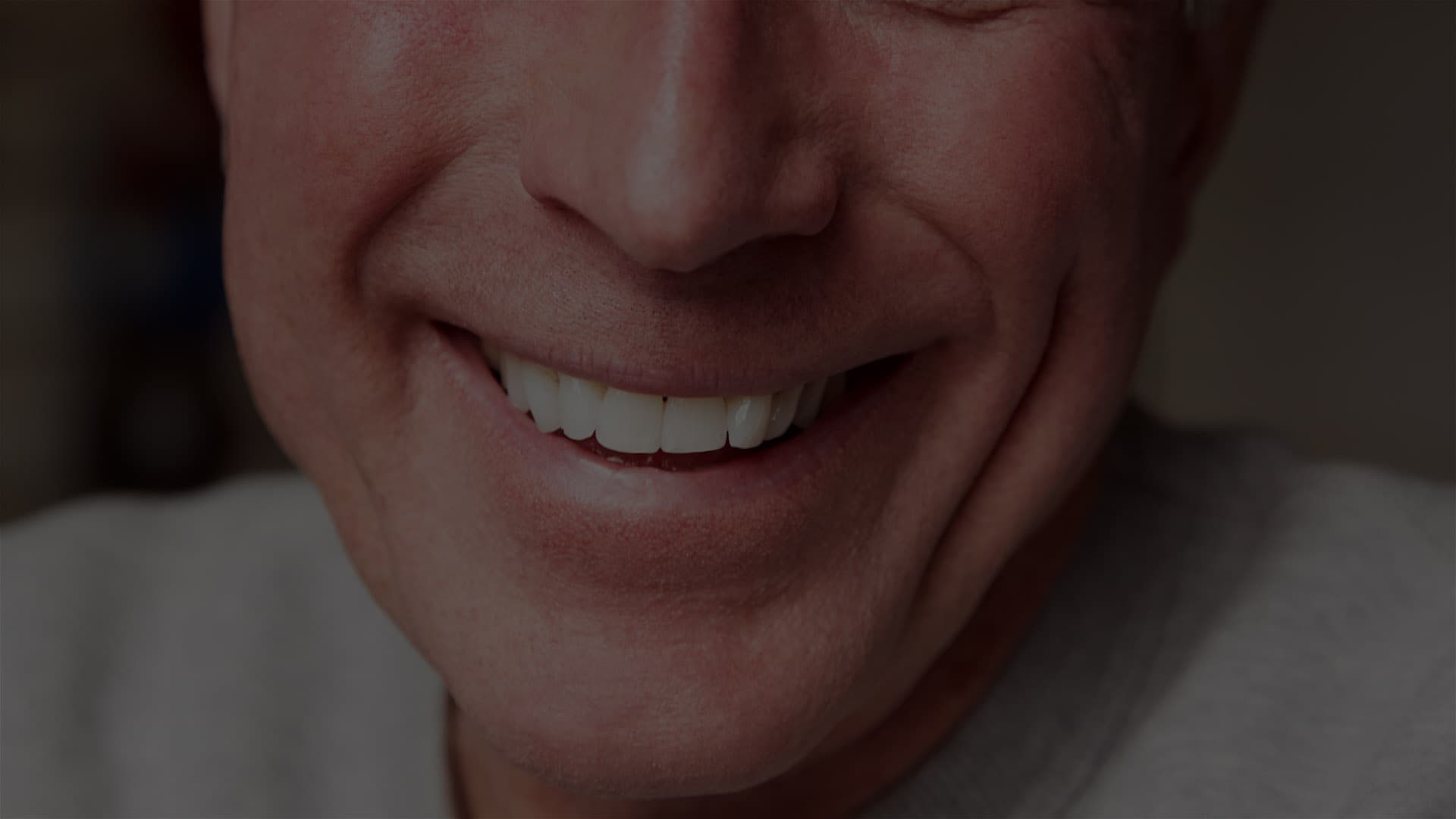 Dental implant procedure at Applemint Dental Beverly Hills