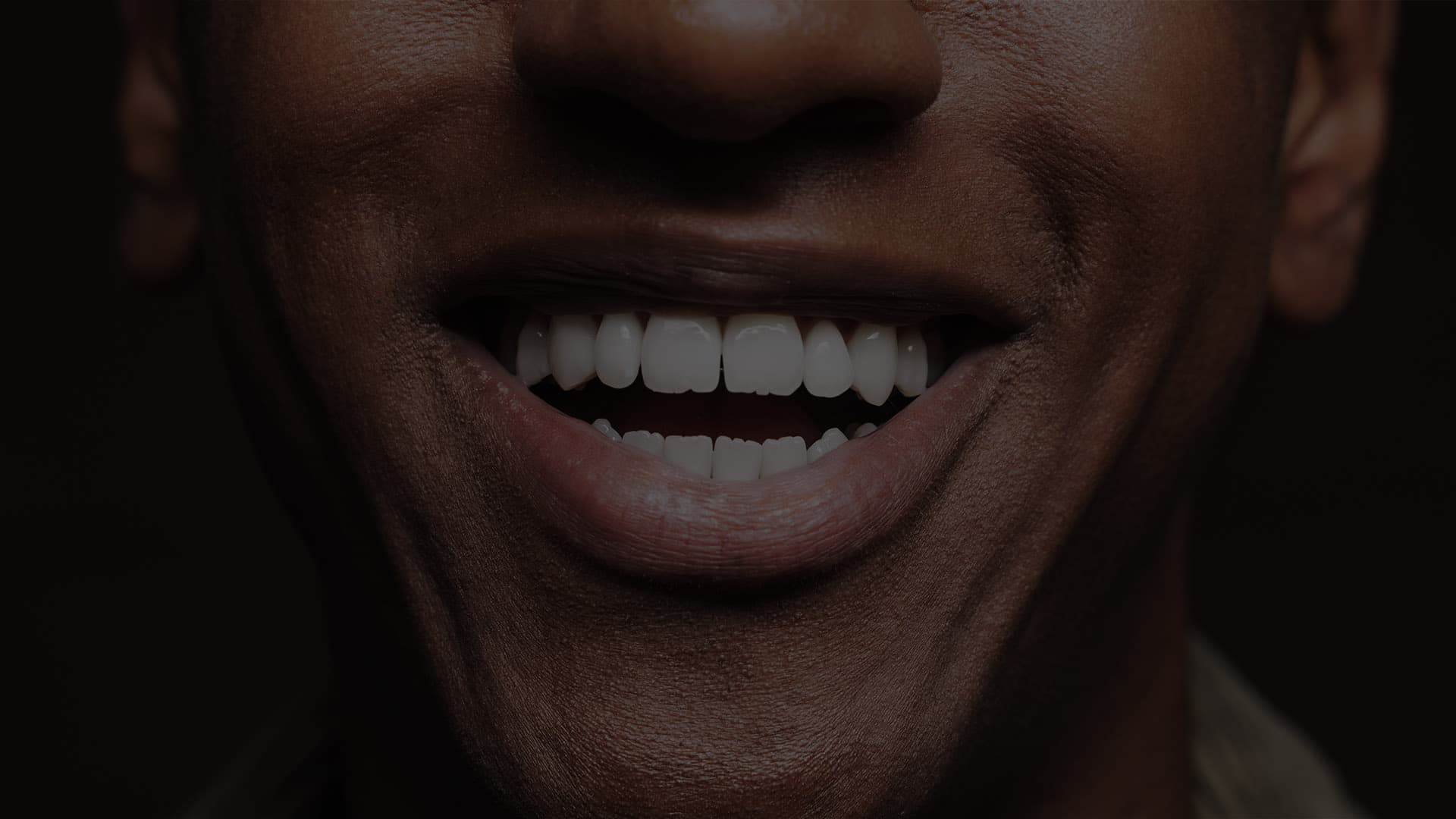 KöR teeth whitening system Beverly Hills